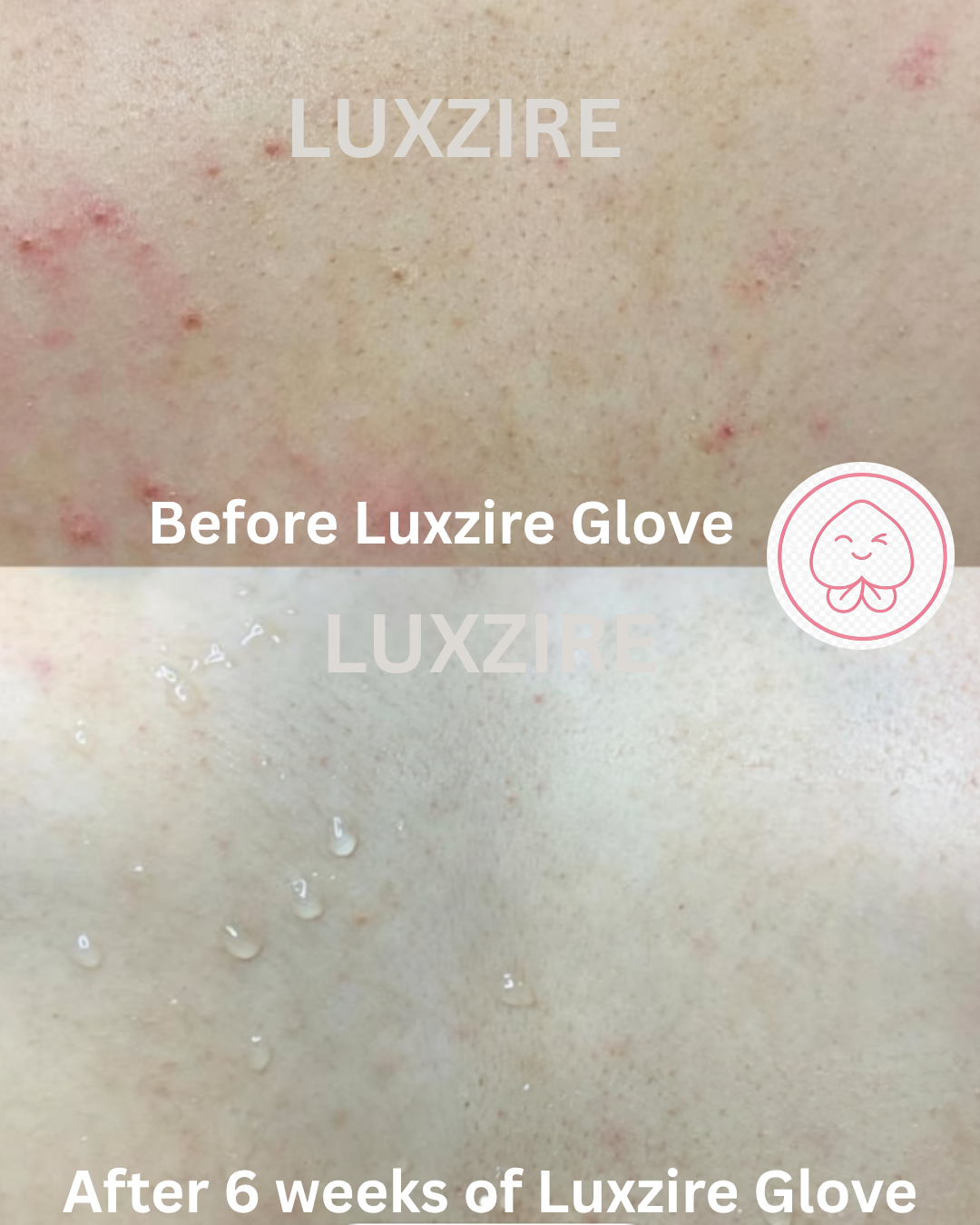 Luxzire Exfoliating Glove